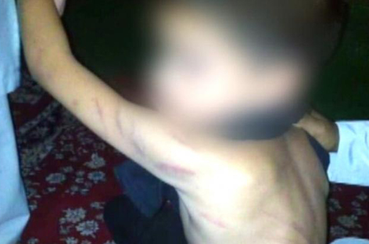 kid beaten.